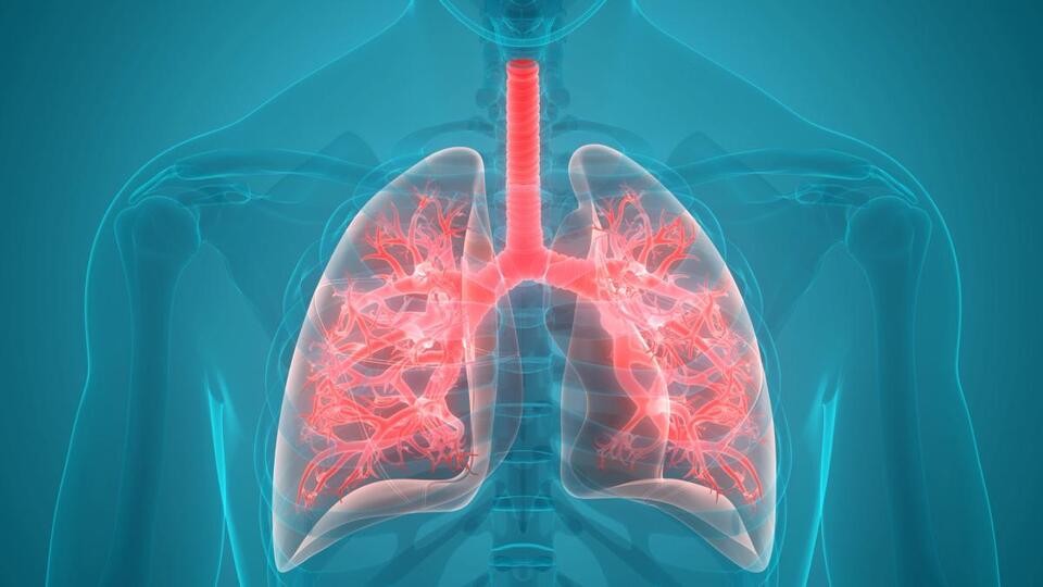 Four Major Idiopathic Pulmonary Fibrosis Advances From 2026 - NewsBreak