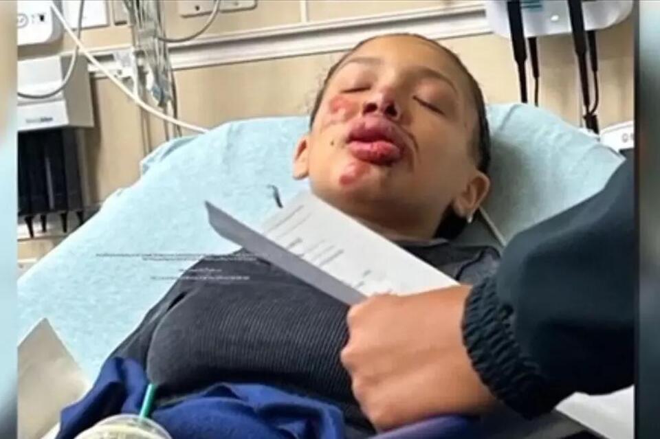 Why Was An Eighteen Year Old In Texas Attacked By Her Friends? - NewsBreak