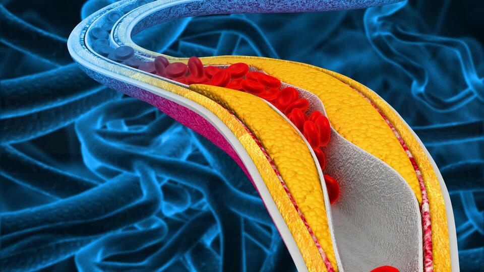 AMERICAN HEART ASSOCIATION UPDATED BLOOD PRESSURE GUIDELINES FOR 2025 visual data 8