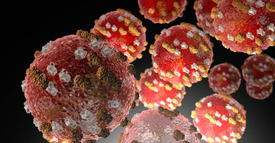 Measles count in Kentucky rises to 157 as cases spread in several ...