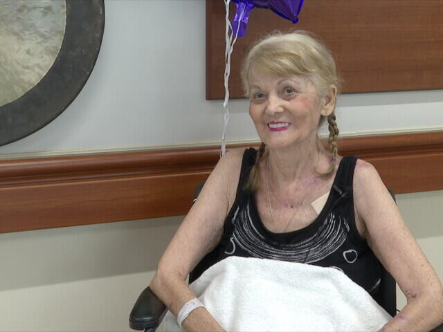 Arizona woman goes home after surviving severe heat burns