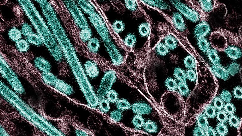 Claude helped plan risky bird flu research. What did the AI add?