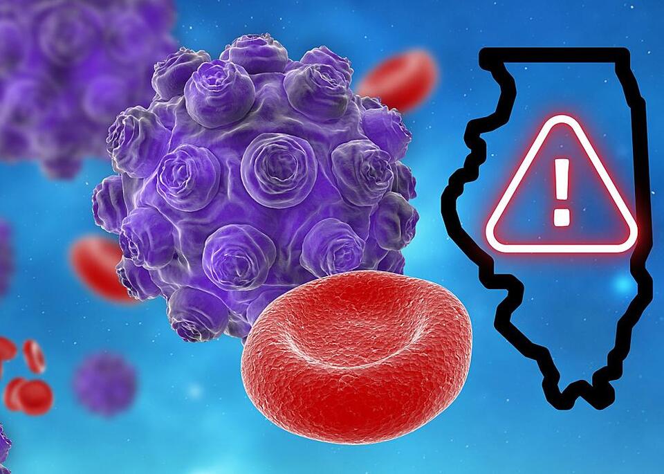 What’s With This Highly Contagious Virus Outbreak In An Illinois City ...