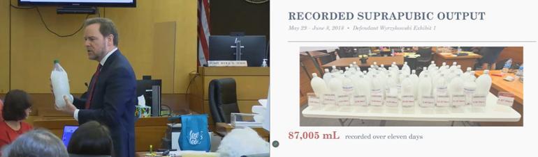 Georgia Jury Awards $15M in Med Mal Trial Over Patient's Death Following Lymphatic Fluid Leak