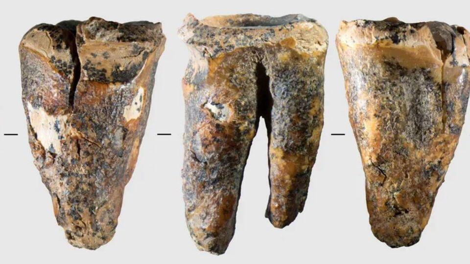 59,000-year-old tooth offers a rare glimpse into how Neanderthals handled a medical problem
