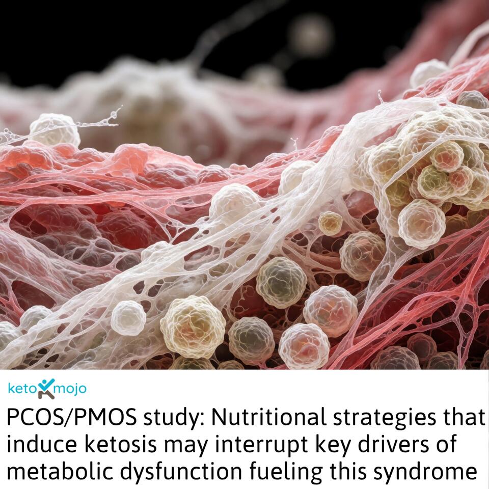 Breaking the metabolic-inflammatory vicious cycle in polycystic ovary ...