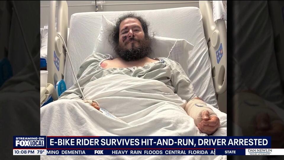 E-bike rider survives hit-and-run crash, driver arrested - NewsBreak