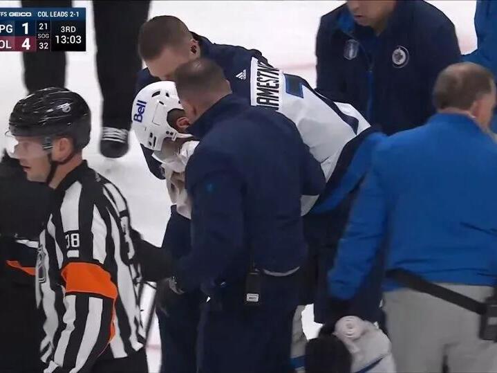 NHL star suffers major scare after being hit in face with puck after