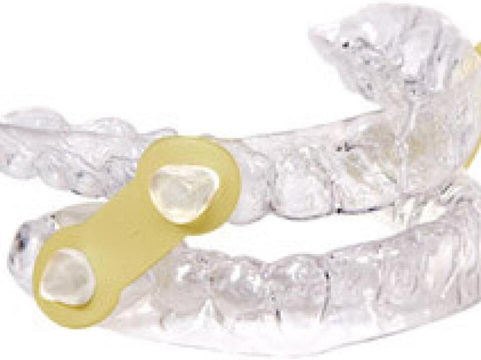 Can I use an oral appliance instead of my CPAP during vacations? Ask the Expert