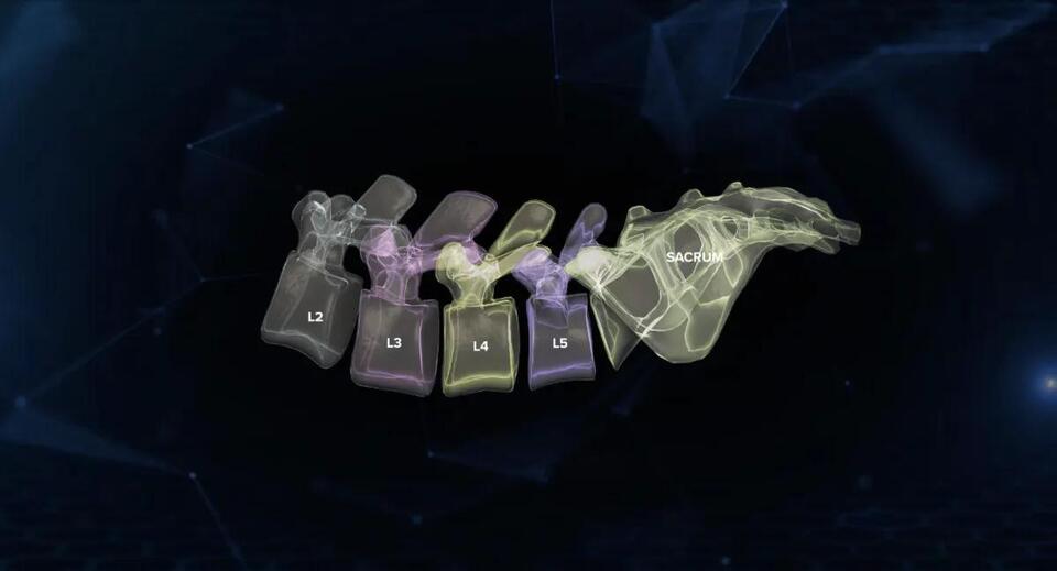 How VB Spine is Building an AR Ecosystem