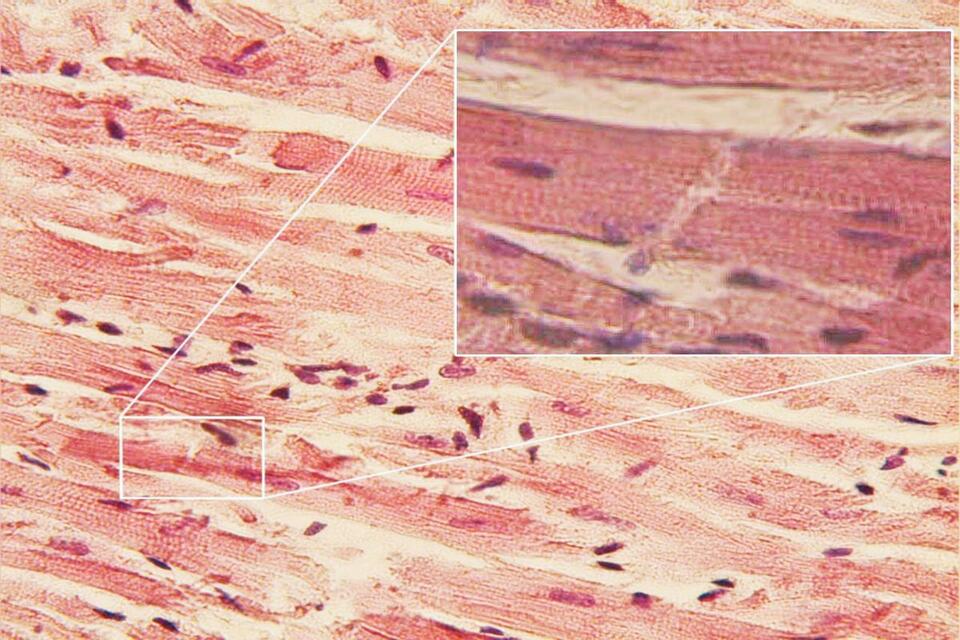 38 Facts About Cardiac Muscle - NewsBreak