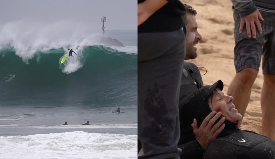Brent Weldon’s Film on the Wedge Sheds Light on the Reality of Getting Hurt There