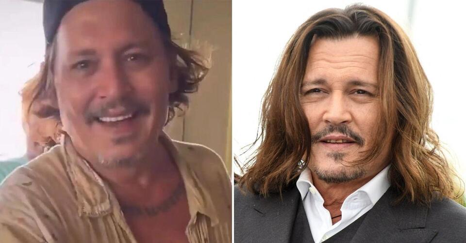johnny depp plastic surgery Image 3
