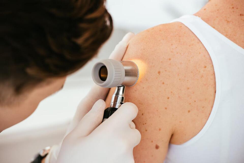 Breakthrough cancer vaccine reduces melanoma from returning by 42%, data shows