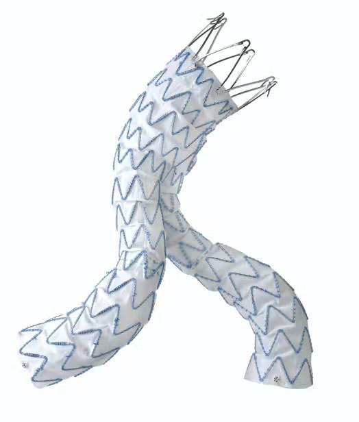 Medtronic’s Endurant Stent Graft System Receives Updated Ruptured AAA ...