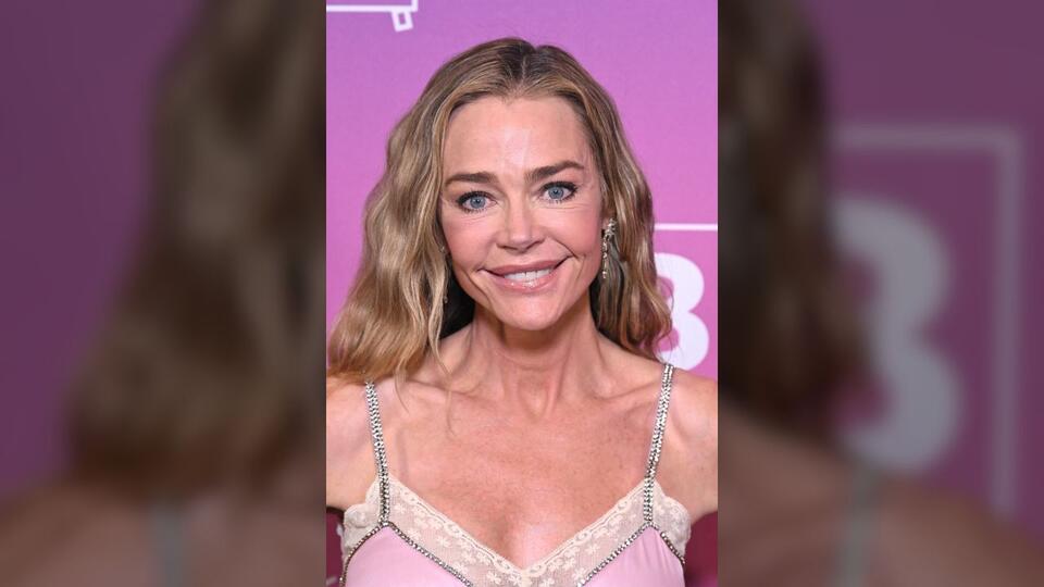 Denise Richards breaks down details of her facelift in candid interview: ‘I was scared’