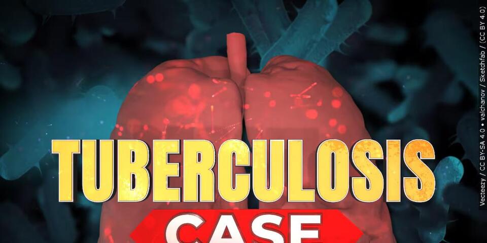Mass testing required for Taylor County mine employees after active ...