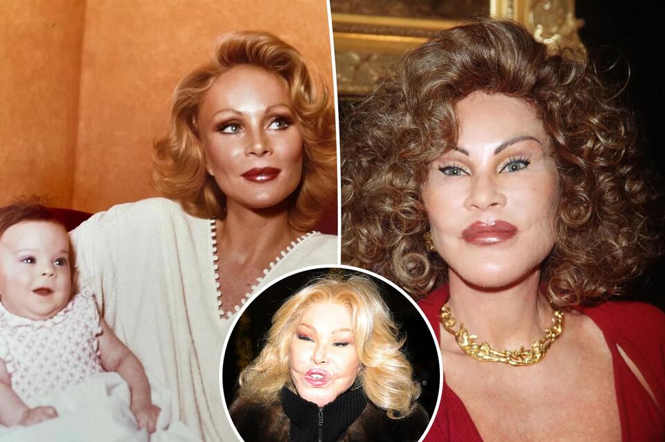 Jocelyn Wildenstein was a cautionary tale of extreme plastic surgery