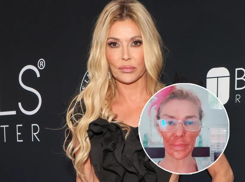 Brandi Glanville Says She Put Nair on Her Face to Fight Parasite: 'I