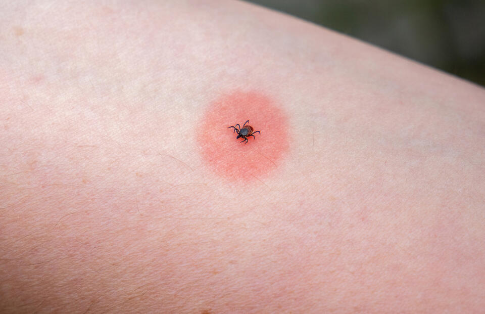Macon County Health Department Reminds Residents to Watch for Ticks ...