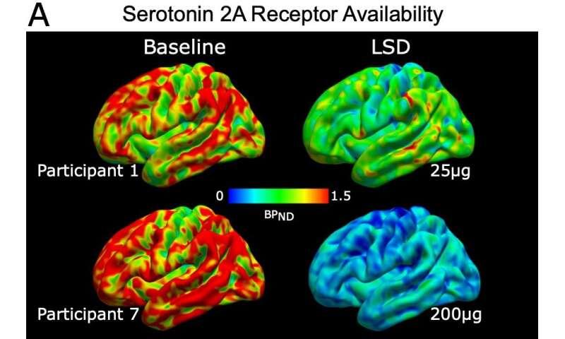 LSD and psilocybin push brain blood flow in opposite directions, study suggests