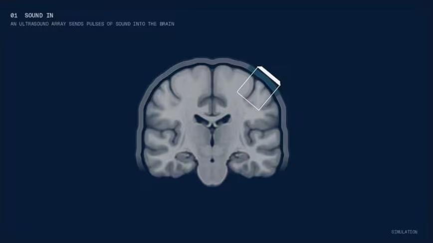 Bridge Neurotech raises $13.5M to read brains with ultrasound, no ...