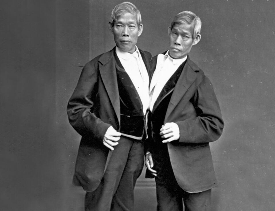 The Tragic Lives of Famous Conjoined Twins Eng And Chang Bunker - NewsBreak