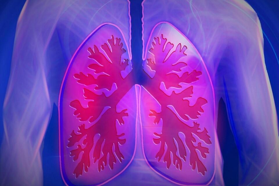 50 Facts About Pneumonoultramicroscopicsilicovolcanoconiosis - NewsBreak
