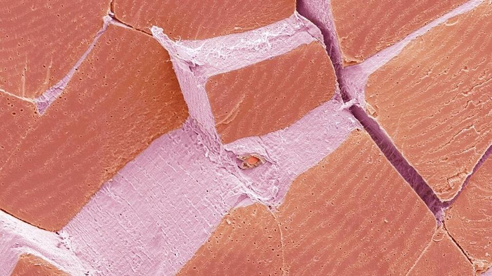 Test Your Eyes: What Is This Week's Microscope Mystery