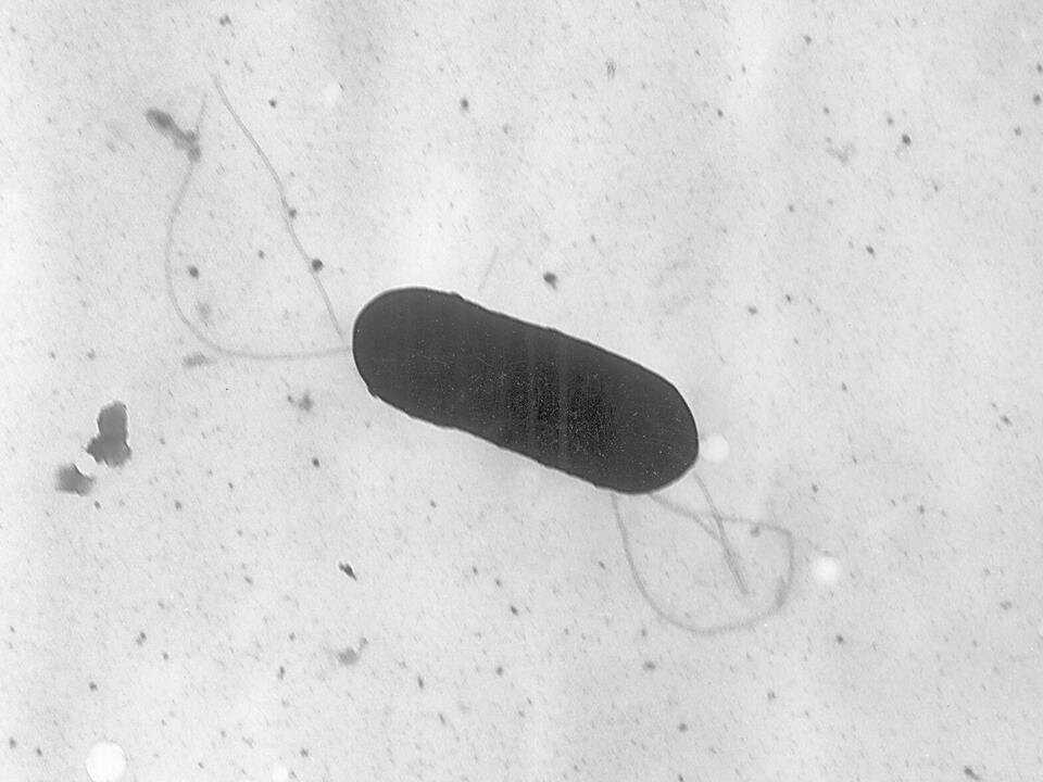 Recall of Boar's Head deli meats announced during investigation of