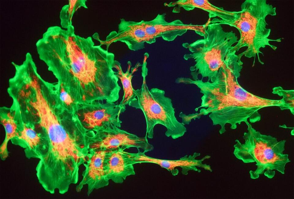 Memory loss is reversed by ‘activating’ the mitochondria in the brain ...