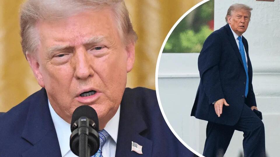 Trump Health Concerns Ramp Up as Prez Slaps His Leg While Walking