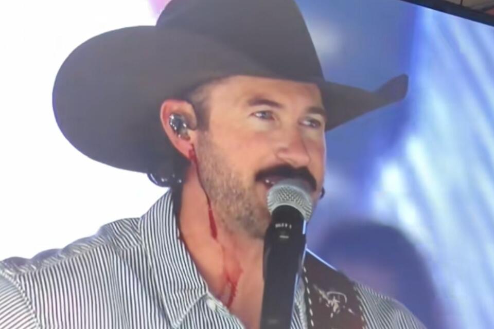 Riley Green Injured After Being Hit in the Face With a Phone Onstage ...