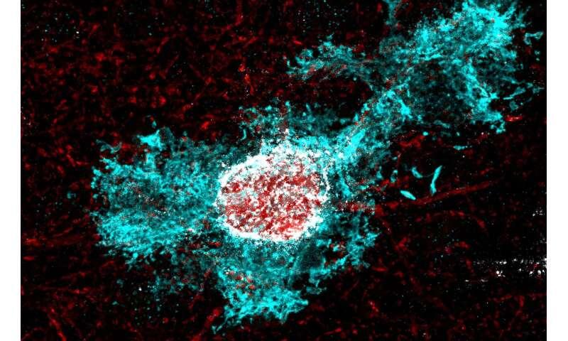 How stress hormone shapes brain development: New clues to why early plasticity fades
