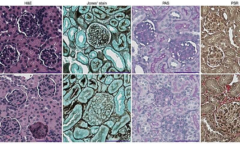 'Toxic' molecule may play vital role in gene regulation and development