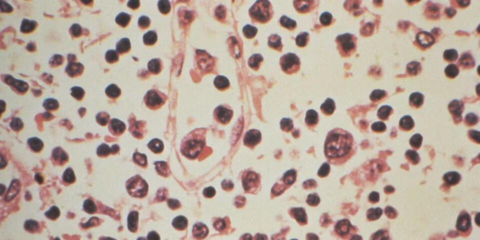 Hantavirus detected on Pine Ridge Reservation as officials urge ...