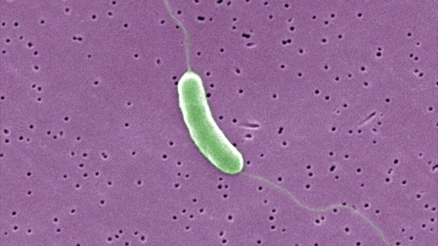 Health commissioner raises alarm about potential flesh-eating vibriosis ...