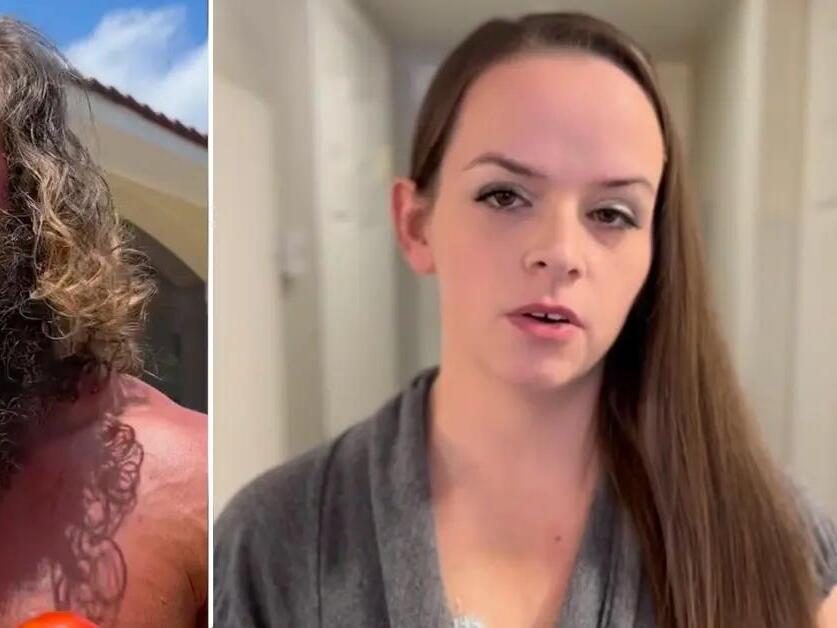 Influencer Liver King Promotes GoFundMe of Retired MMA Fighter Who's