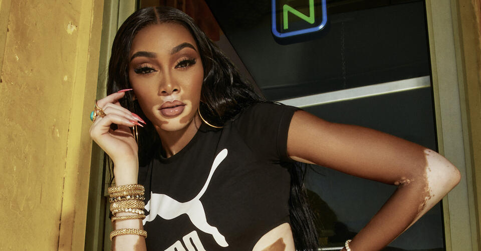 Winnie Harlow Models Puma’s Cali Dream Sneakers in a Vibrant Campaign Shot in Jamaica – NewsBreak