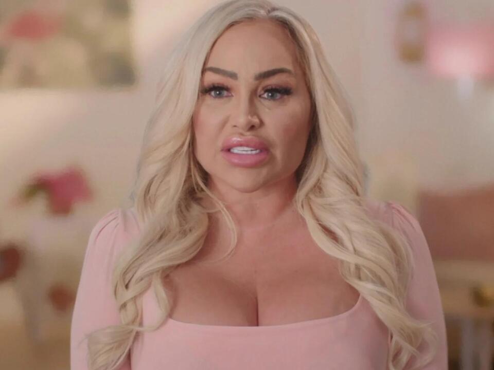 Does ‘Darcey and Stacey’ Star Stacey Silva Have Vitiligo? Details on