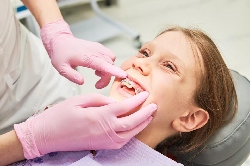The Benefits of Early Orthodontic Treatment