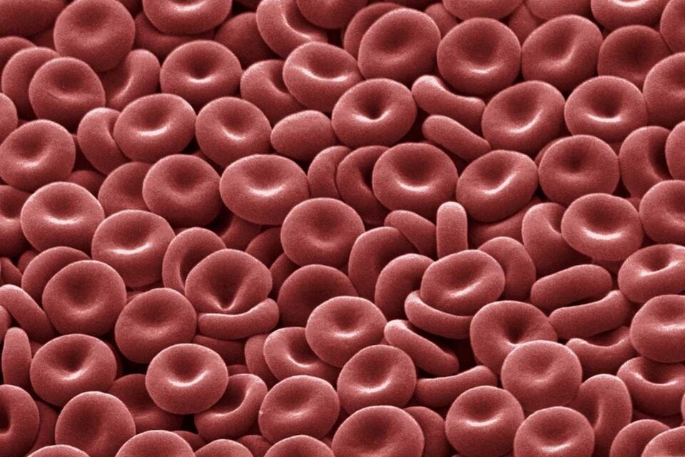 31 Facts About Erythrocyte - NewsBreak