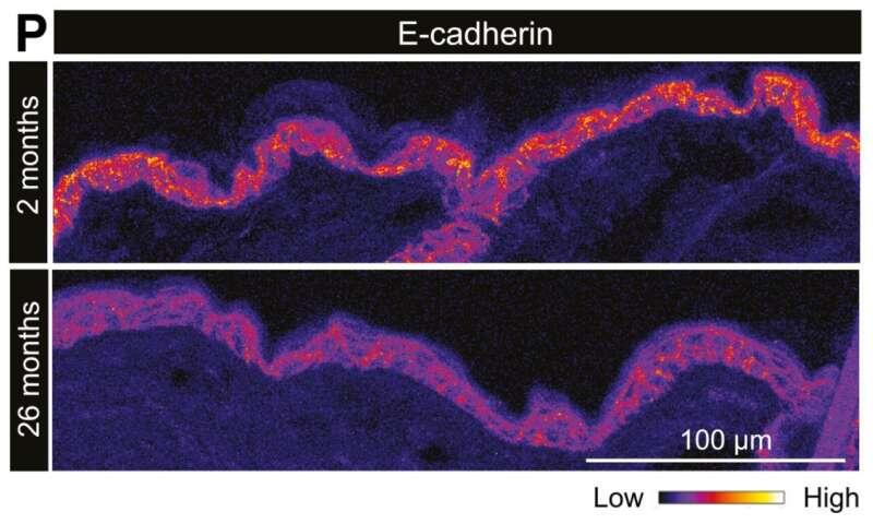 Unprecedented view inside live stem cells reveals aging process and loss of regenerative capacity