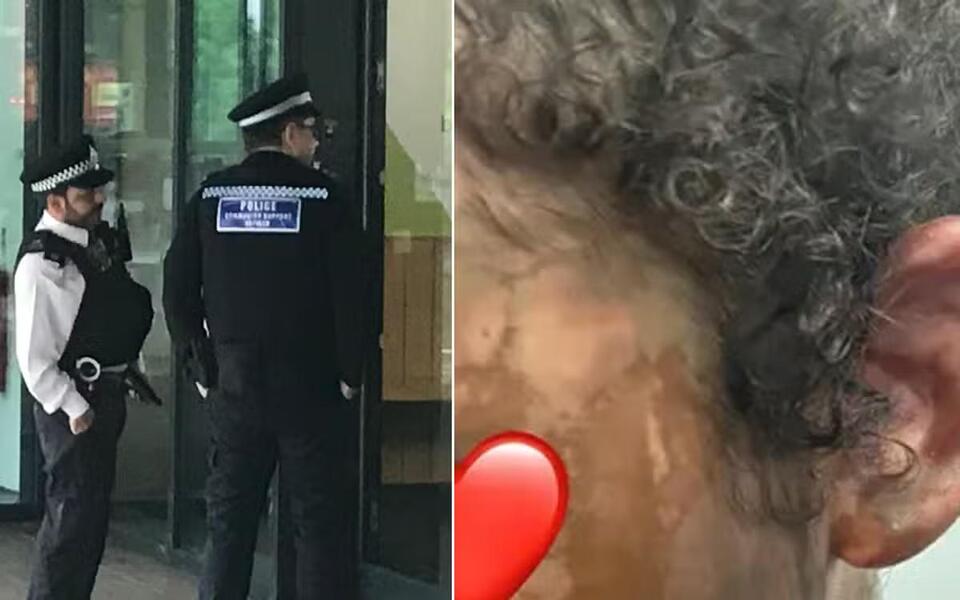 Police probing whether west London acid attack linked to school dispute ...