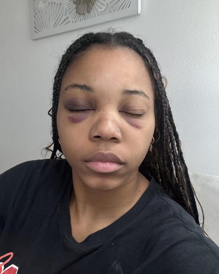 Viral video of Arizona college student slammed to ground by police and punched draws national outcry