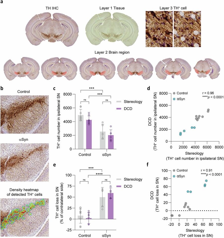 Development of convolutional neural networks for automated brain-wide ...
