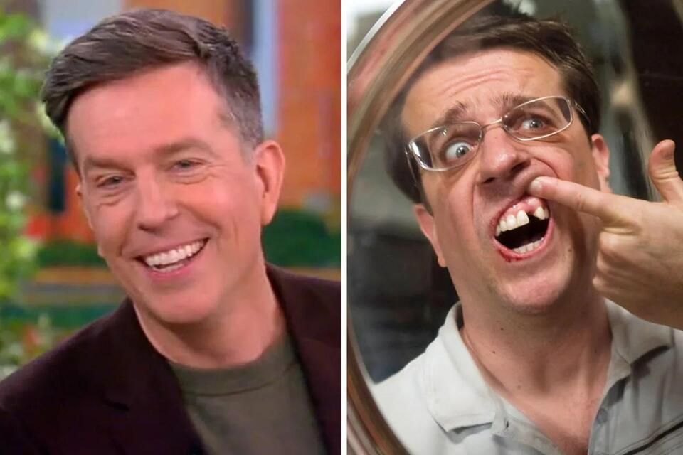 Ed Helms Shocks ‘The View’ With Reveal That His Missing Tooth In ‘The