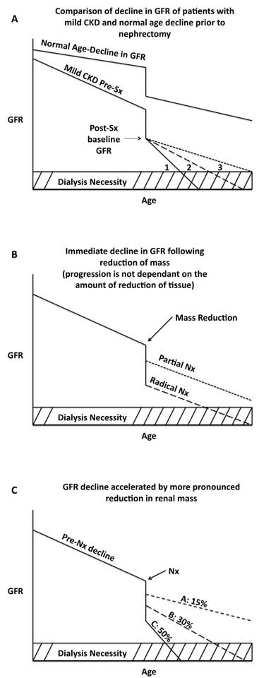 Residual renal function after partial or radical nephrectomy for renal cell carcinoma