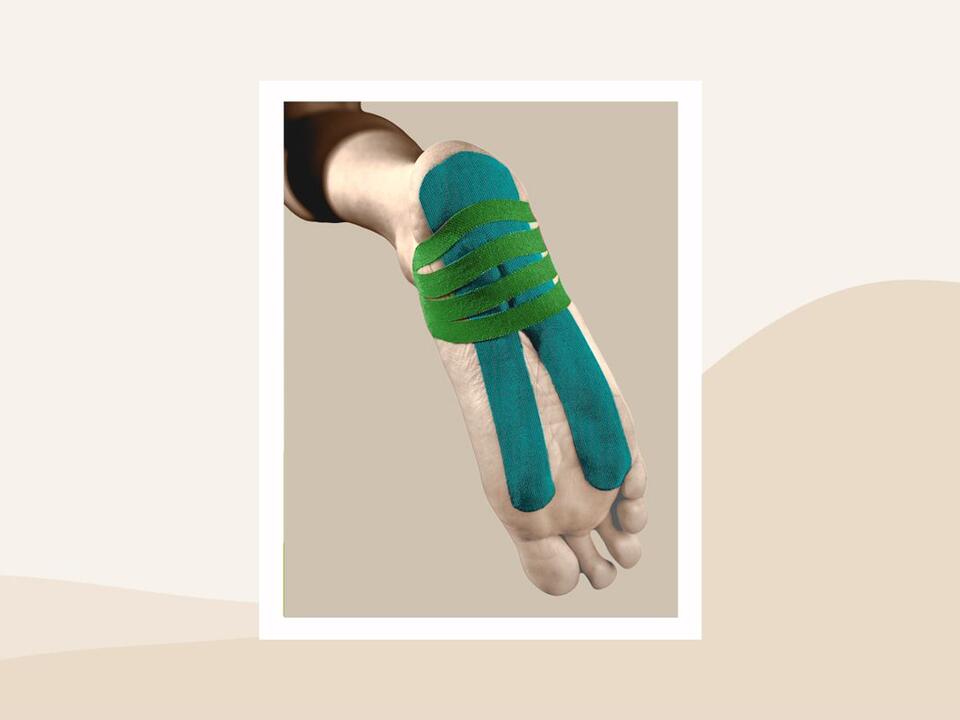 Does Foot Taping for Plantar Fasciitis Really Help?