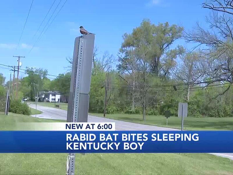WATCH Rabid bat bites sleeping Kentucky boy